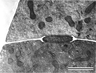 vegetative hypha of Kickxella alabastrina