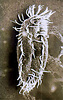 Scanning electron micrograph of hypotrich Stylonychia