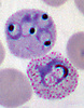 micrograph depicting a red blood cell containing four Plasmodium vivax rings, next to a growing trophozoite