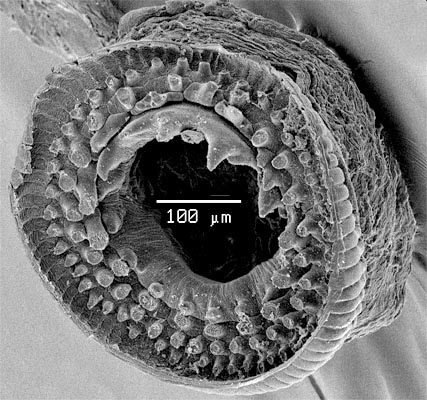 SEM_photograph_of_a_small_manus_sucker.