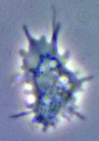 Amoeba Cytoplasm
