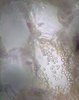 Cyanobacteria within a coralloid root of a cycad (Bowenia spectobilis).