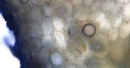 Cyanobacteria are visible within this coralloid of a cycad (Bowenia spectobilis).
